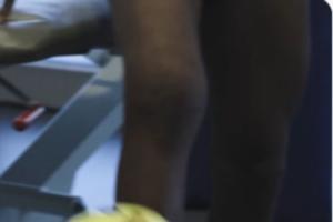 十字韧带+外侧半月板断裂！罗德里戈晒训练视频 右腿肌肉萎缩明显